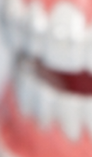 성인 돌출입 교정, 발치 없이도 변화가 가능할까? 관련 이미지 37