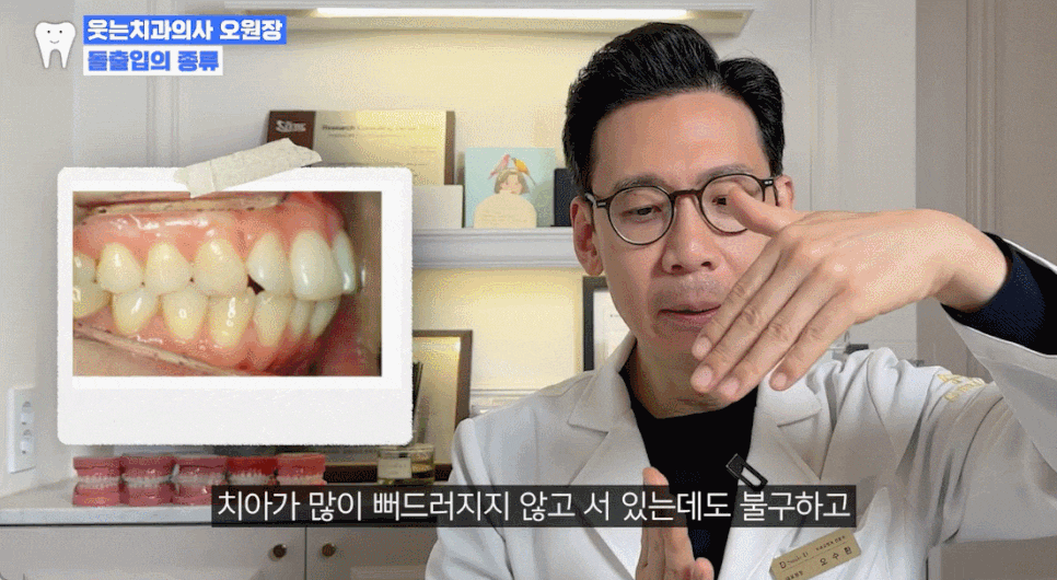 Non-extraction orthodontics? If you have this kind of protruding mouth, orthodontic treatment will not be effective image 13