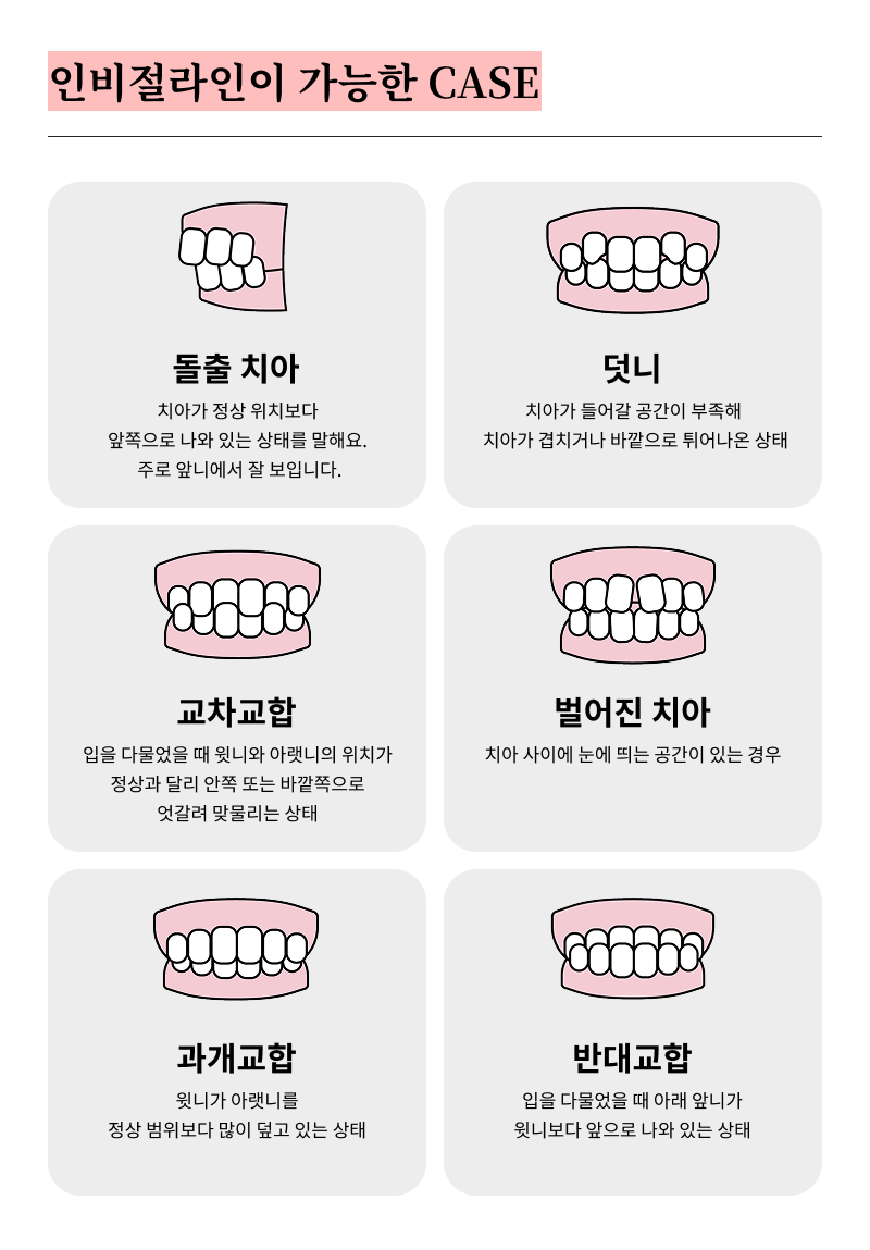 Criteria for Choosing a Great Orthodontic Clinic in Gangnam: A Choice Without Failure! image 14