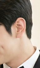 Seoul Dental Clinic Recommendation: If You’re Considering Laminate Veneers image 32