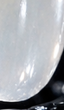 논현역 라미네이트 치과 후회 없는 선택을 위해 체크할 요소들 관련 이미지 32