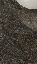 Systematic Examination Process to Review Before Deciding on Front Teeth Laminates image 36