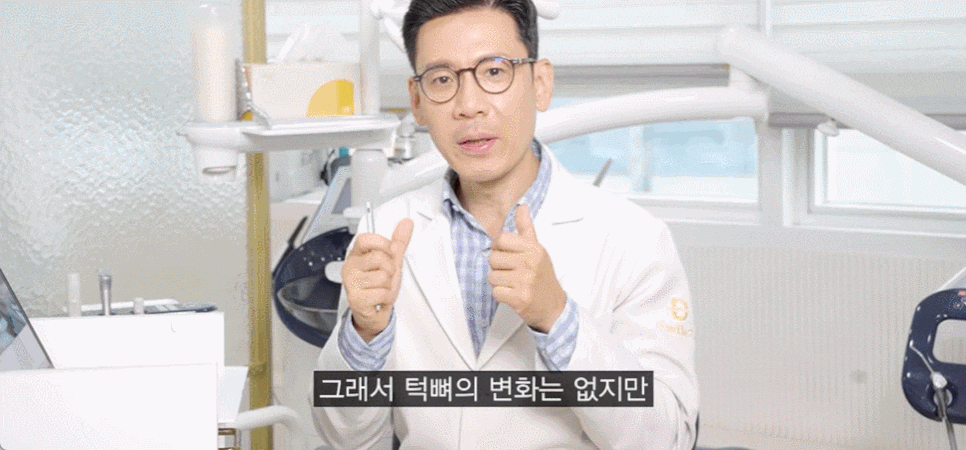 Underbite Tooth Correction? How to Improve a Receded Chin Without Double-Jaw Surgery or Chin Surgery image 6