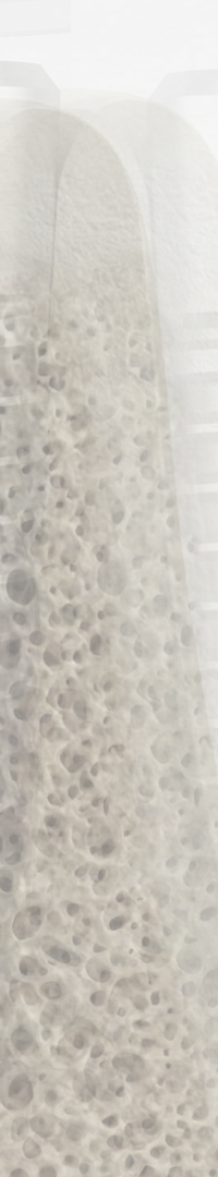 Invisalign Retainer Duration: A Detailed Look image 35