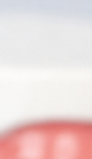 성인 돌출입 교정, 발치 없이도 변화가 가능할까? 관련 이미지 31