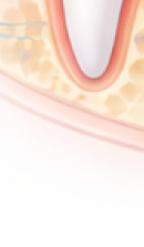 강남 교정치과 과정과 필수 분석 사항들 관련 이미지 43