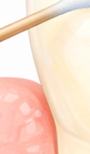 압구정 교정 치과 정밀 진단이 중요한 이유? 관련 이미지 35