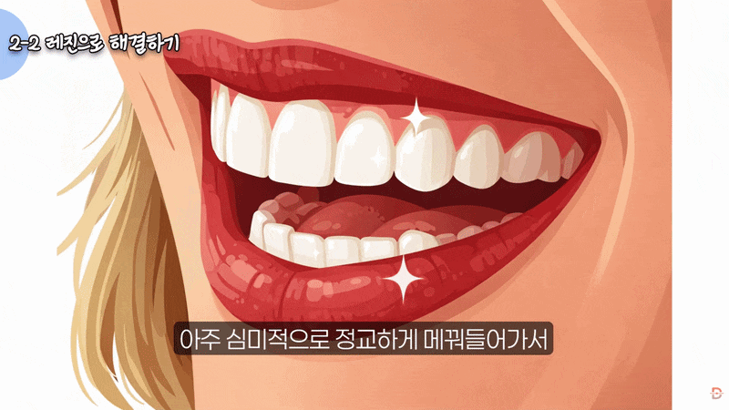 논현역 치과 라미네이트, 레진 치료만으로 충분할지 고민된다면 관련 이미지 6