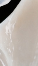 서울교정치과 선택 전 확인해야 할 정밀 진단 기준 관련 이미지 30