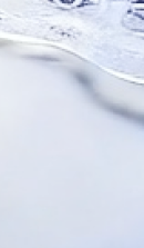 강남 임플란트 치과 초기 단계의 정밀한 분석이 중요한 이유 관련 이미지 40