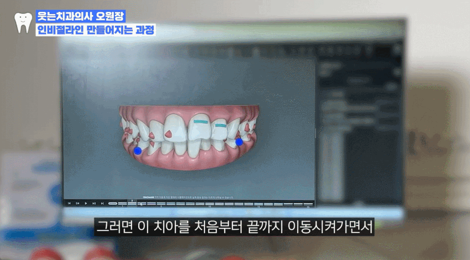 Gyodae Station Dental Clinic Invisalign Orthodontic Prices and Reviews at a Glance image 9