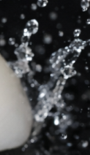 신사역 라미네이트 치과, 자연스러운 미소를 결정짓는 비밀 관련 이미지 24