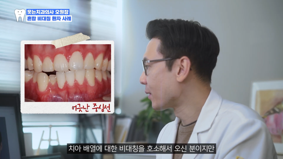 신사역치과 안면비대칭 수술없이 가능할까 관련 이미지 7