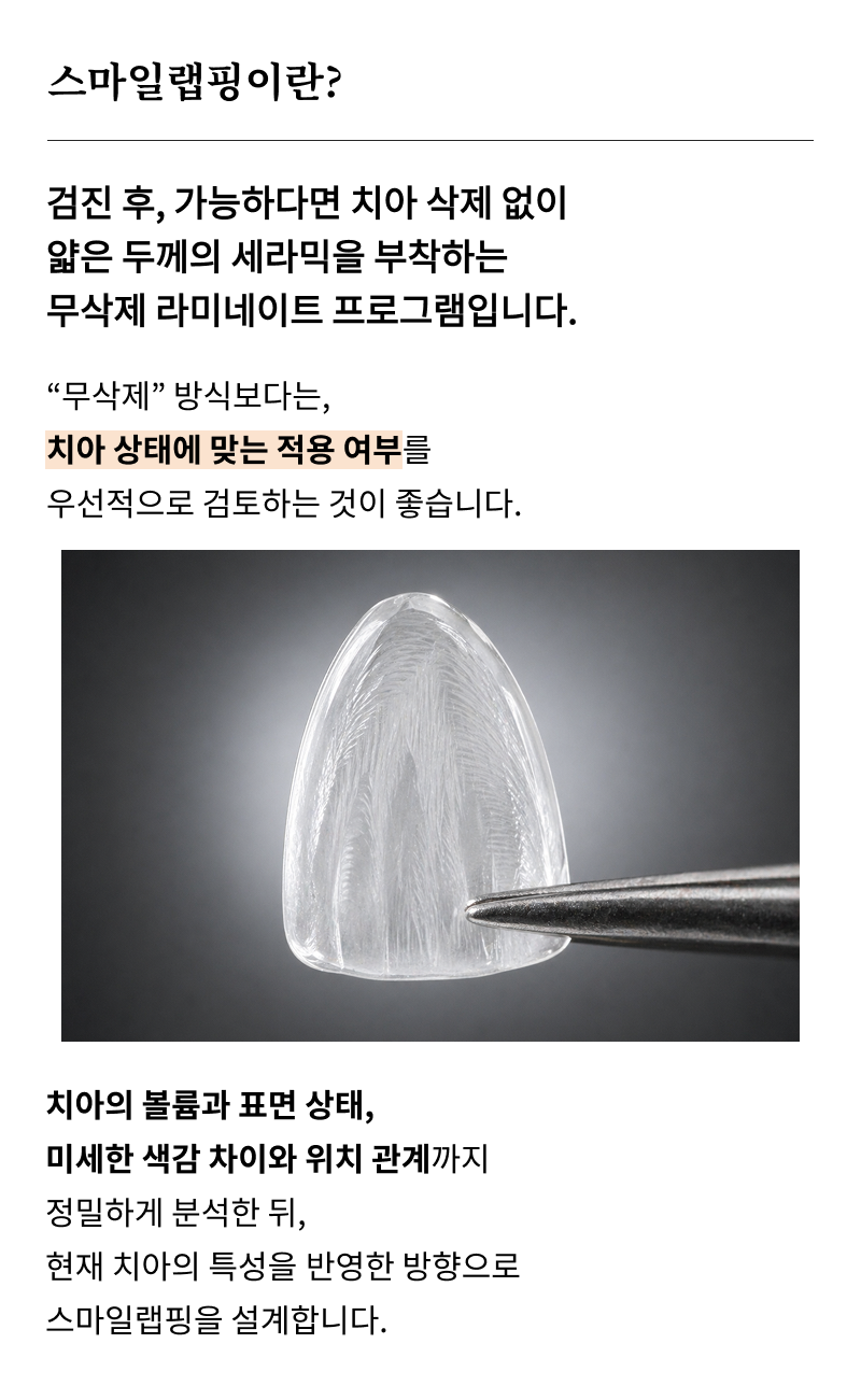 신사역치과 라미네이트 찾아보고 있다면 관련 이미지 9
