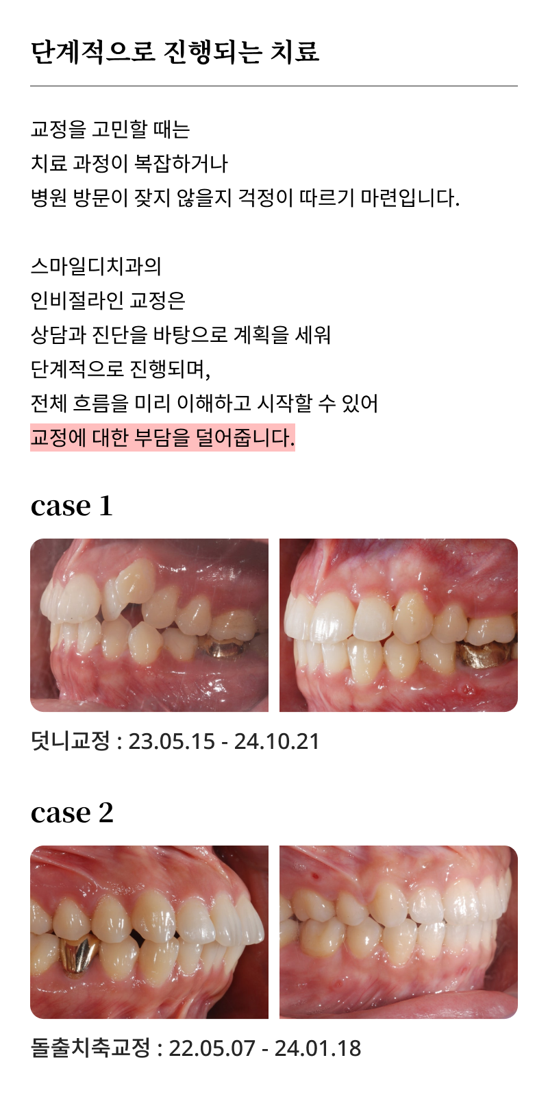 Criteria for Choosing a Great Orthodontic Clinic in Gangnam: A Choice Without Failure! image 18
