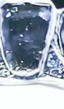 강남 임플란트 치과 초기 단계의 정밀한 분석이 중요한 이유 관련 이미지 29