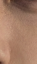 논현역교정치과 선택 전 반드시 확인해야 할 체크 포인트 관련 이미지 38