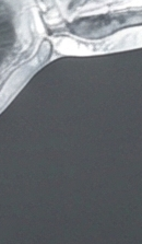 강남교정치과 선택 시 확인해야 할 핵심 기준과 정밀 진단 관련 이미지 39