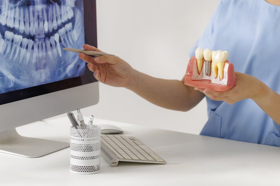 강남임플란트잘하는곳, 내 치아 같은 편안함은 어떻게 만들어질까? 관련 이미지 5