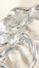 Gangnam Dental Clinic Orthodontics: Is Treatment Possible for Adults? image 27