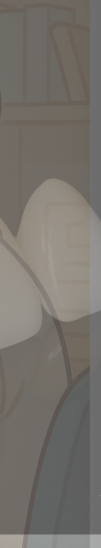 무삭제 라미네이트 추천 시작부터 결정까지 정리 관련 이미지 31