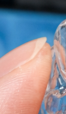 강남 교정전문의치과 고민된다면 관련 이미지 32