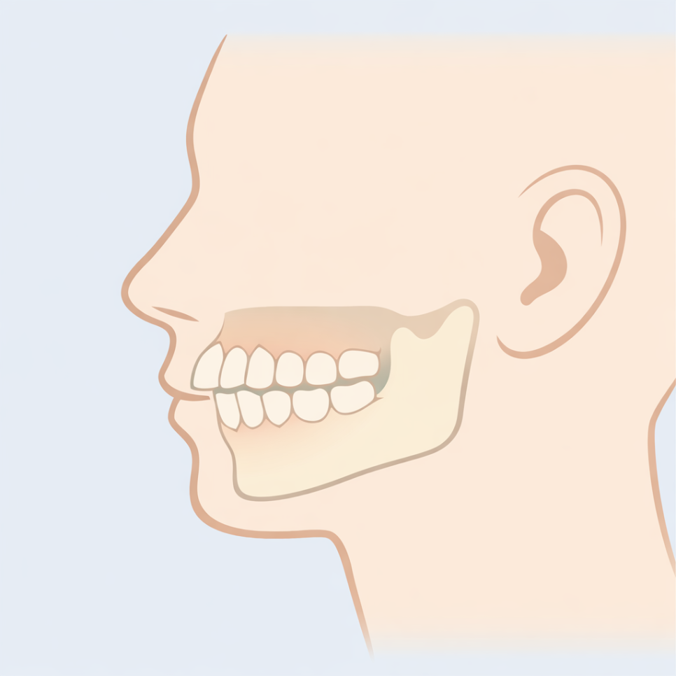 부정교합 종류 총정리 나는 어디에 해당할까? 덧니·돌출입·주걱턱 관련 이미지 3