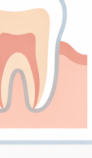 압구정 라미네이트치과 자연스러운 완성을 위한 선택 기준? 관련 이미지 28