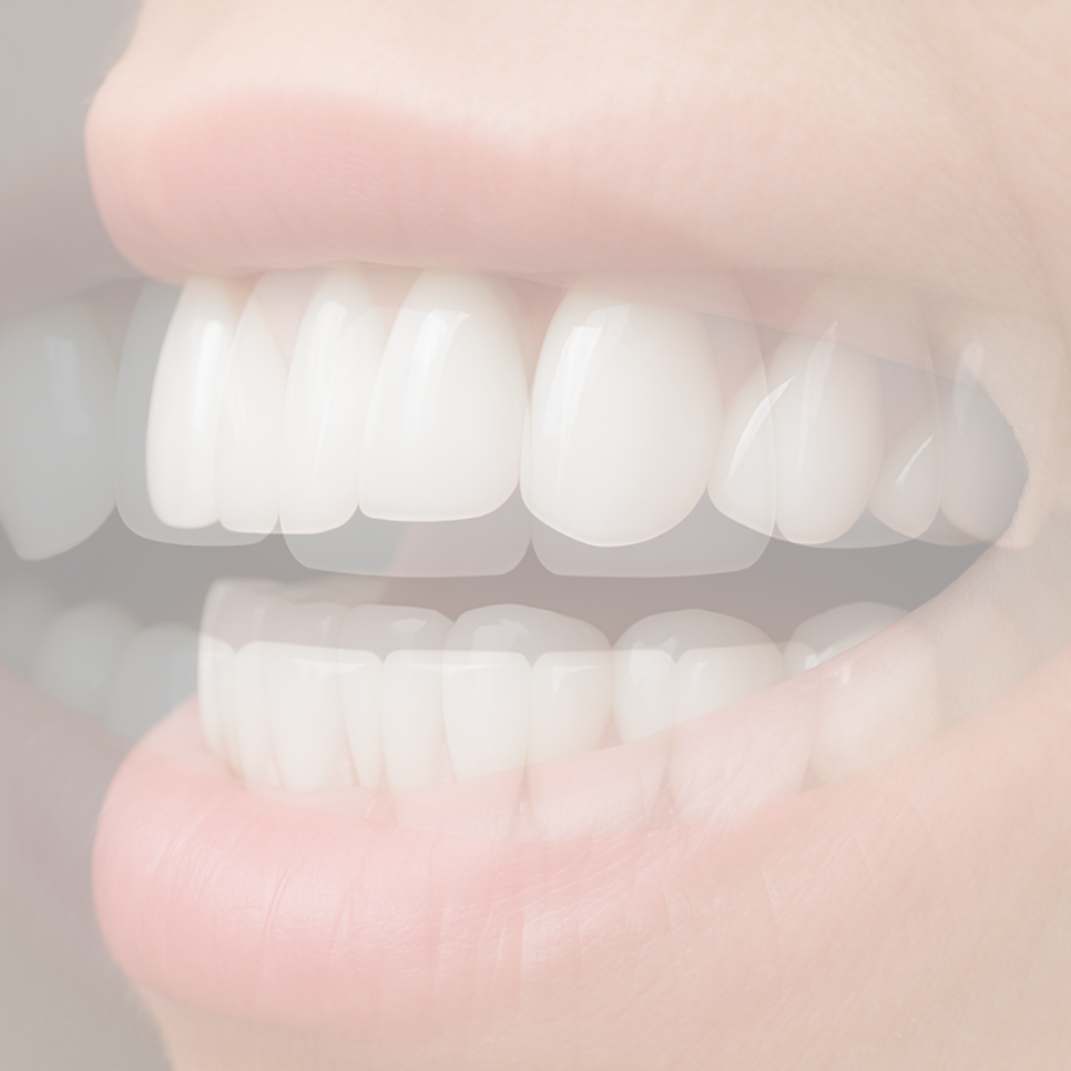 라미네이트 가격 병원 선택 전 꼭 알아야 할 점 관련 이미지 34