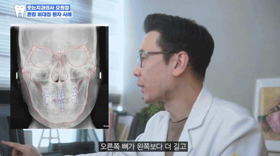 신사역치과 안면비대칭 수술없이 가능할까 관련 이미지 8