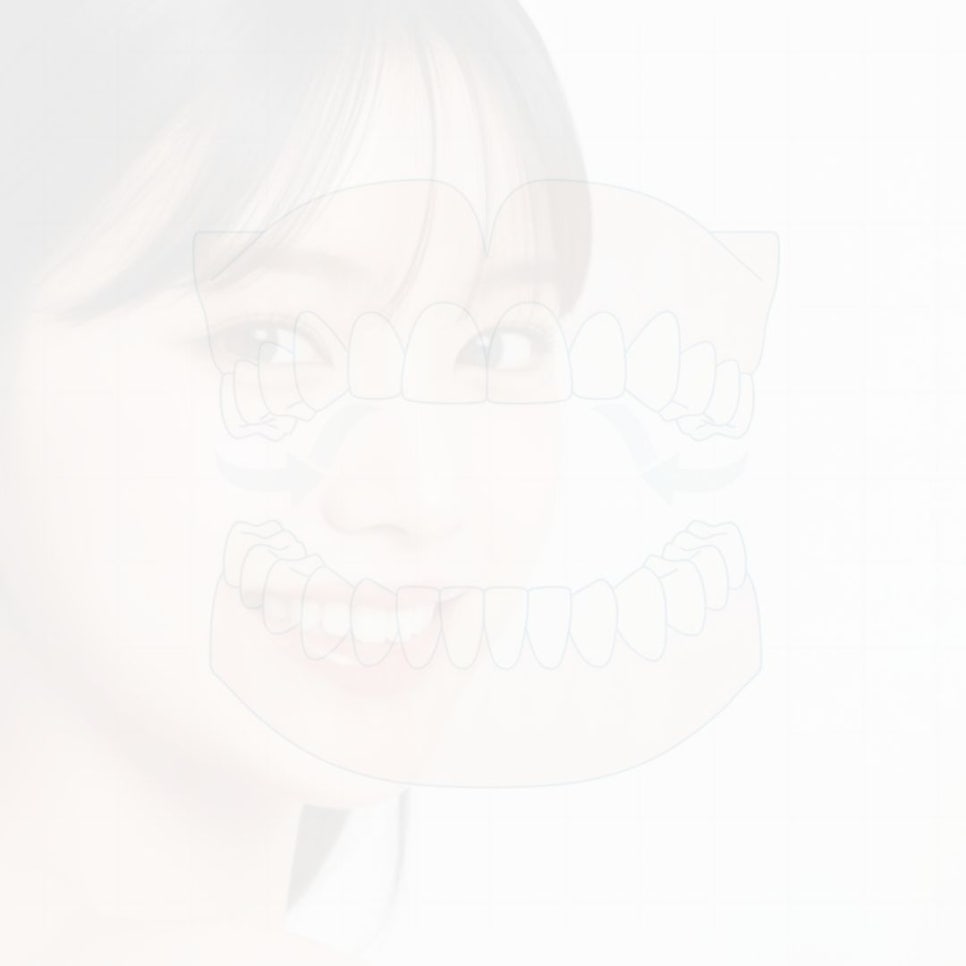 무삭제 라미네이트 후기 꼼꼼히 찾아봤어요 관련 이미지 24