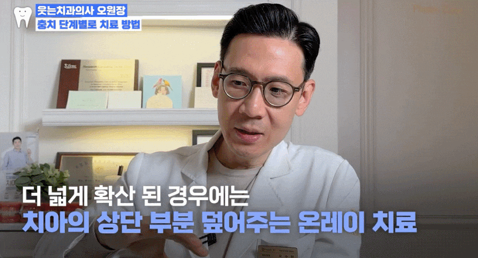 충치 자연치유 어렵기에, 충치단계 치료법 알아두세요 관련 이미지 10