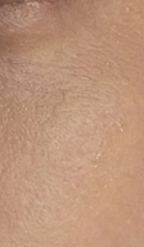 논현역교정치과 선택 전 반드시 확인해야 할 체크 포인트 관련 이미지 39