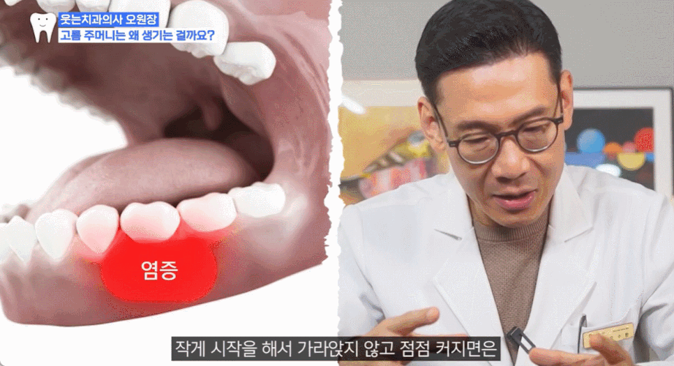 What Causes Painful Swelling on the Inside of the Gums? image 3