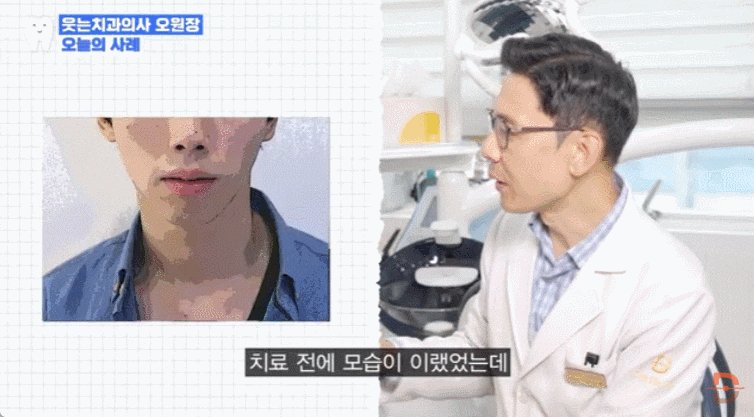 무턱교정 전후 사진만 찾아보고 있다면 반드시 확인해야 할 것들 관련 이미지 9