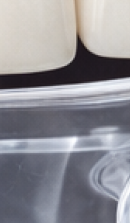 40대 치아 교정 고민 중이라면? 부담 줄이고 효율 높이는 선택법 관련 이미지 33