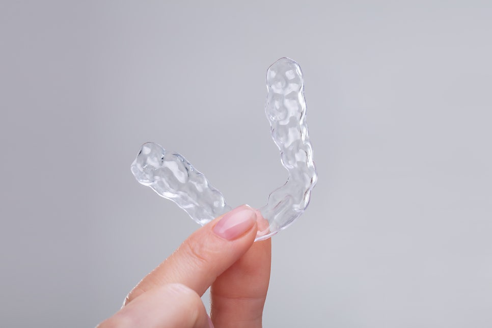 세라믹교정 vs 클리피씨교정, 뭐가 다르고 뭘 골라야 할까? 관련 이미지 7