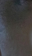 논현역교정치과 선택 전 반드시 확인해야 할 체크 포인트 관련 이미지 35