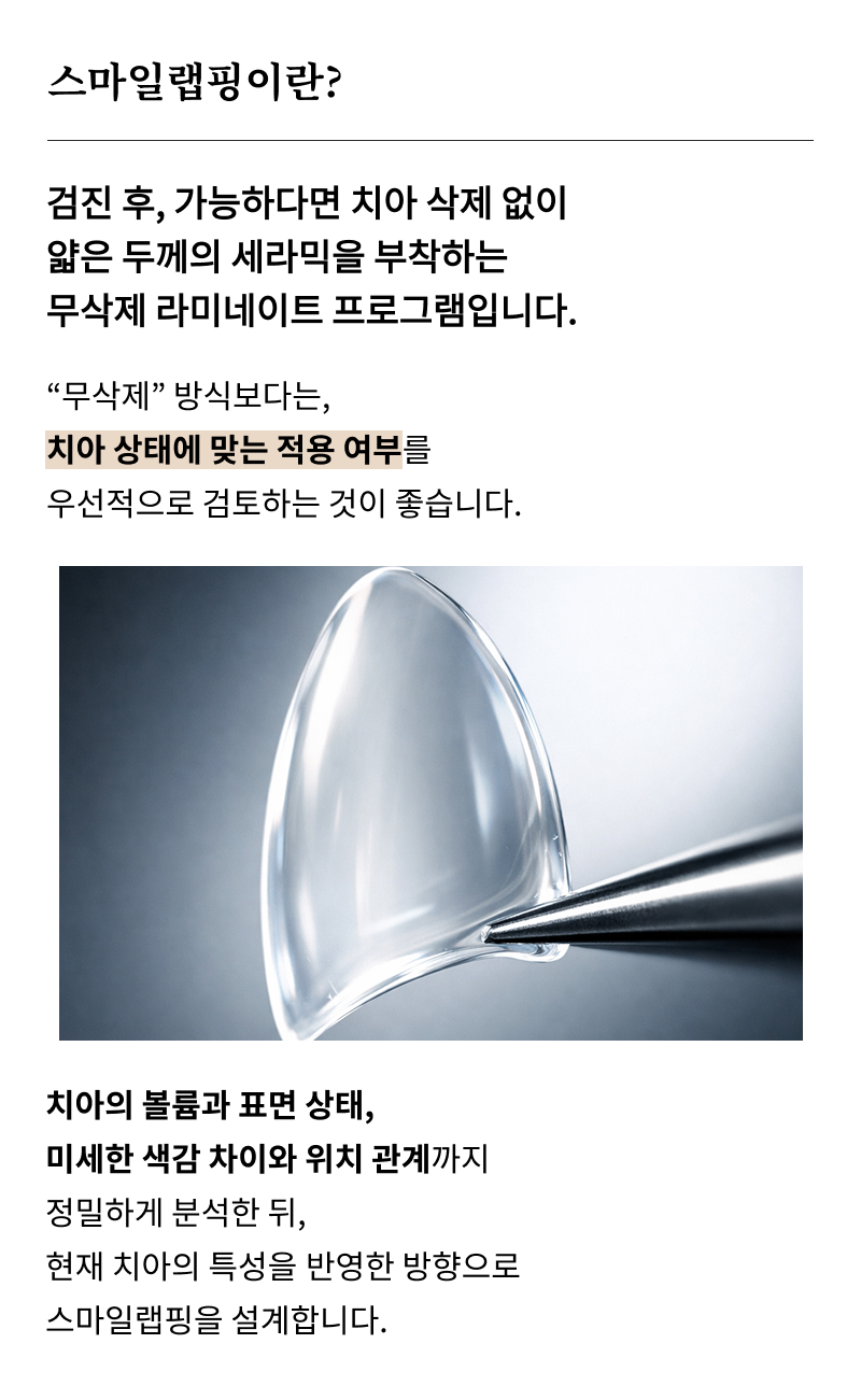 서울라미네이트치과 알아보고 있다면 관련 이미지 10