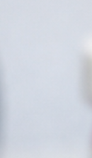 성인 돌출입 교정, 발치 없이도 변화가 가능할까? 관련 이미지 29