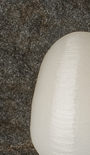 Systematic Examination Process to Review Before Deciding on Front Teeth Laminates image 37