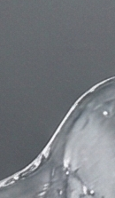 강남교정치과 선택 시 확인해야 할 핵심 기준과 정밀 진단 관련 이미지 28