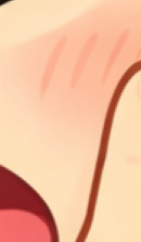 앞니 라미네이트 시술이 고민된다면 관련 이미지 26