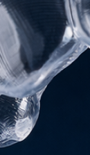 강남교정치과 결정 전 고려할 사항은 관련 이미지 35