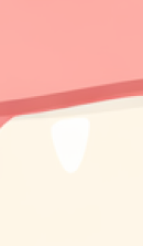 신사역 치과 추천 찾아본다면 관련 이미지 32