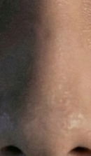 논현역교정치과 선택 전 반드시 확인해야 할 체크 포인트 관련 이미지 37