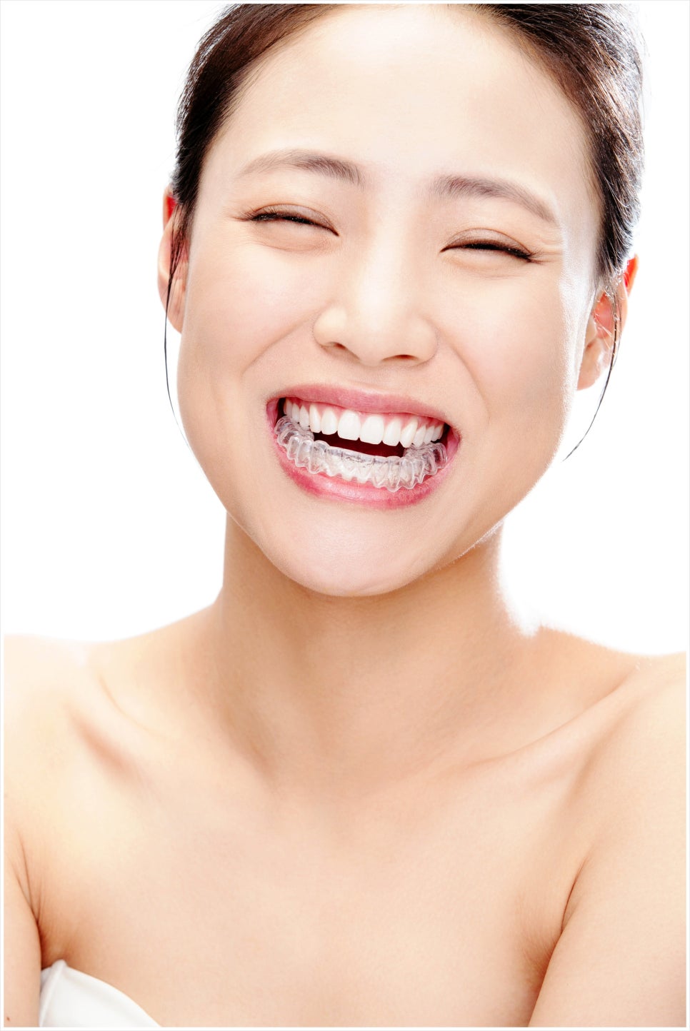 치아 인비절라인 아무도 안 알려주는 솔직한 장단점 (투명교정치과) 관련 이미지 11