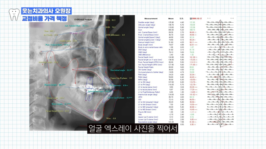 강남교정치과에서 <이것> 안물어보면 손해? 관련 이미지 4