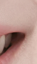 서울라미네이트치과 알아보고 있다면 관련 이미지 31