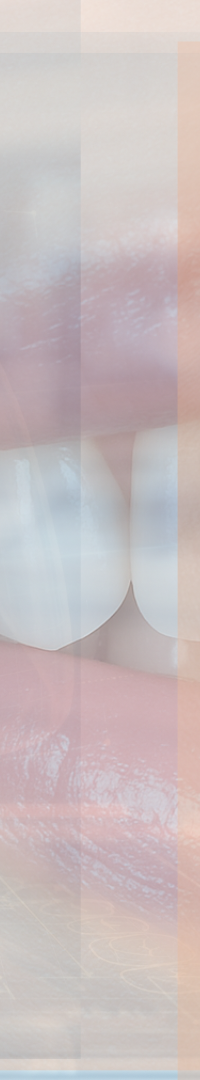 Looking Into Full Implant Placement Methods and Precautions image 36